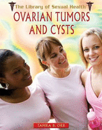 Ovarian Tumors and Cysts