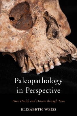 Paleopathology in Perspective: Bone Health and Disease through Time - Weiss, Elizabeth