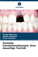 Partielle Extraktionstherapie: Eine neuartige Technik