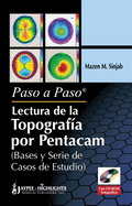 Paso a Paso - Lectura De La Topografia Por Pentacam