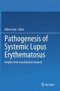 Pathogenesis of Systemic Lupus Erythematosus: Insights from Translational Research