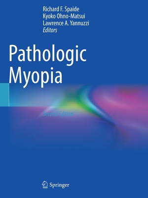 Pathologic Myopia - Spaide, Richard F. (Editor), and Ohno-Matsui, Kyoko (Editor), and Yannuzzi, Lawrence A. (Editor)