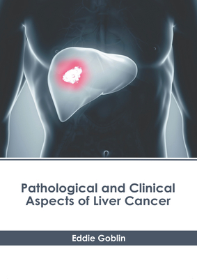 Pathological and Clinical Aspects of Liver Cancer - Goblin, Eddie (Editor)