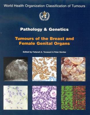 Pathology and Genetics of Tumours of the Breast and Female Genital Organs - Tavassoeli, F a (Editor), and Devilee, P (Editor), and Who