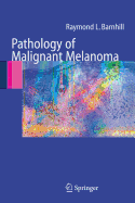 Pathology of Malignant Melanoma