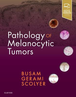 Pathology of Melanocytic Tumors - Busam, Klaus J., and Gerami, Pedram, and Scolyer, Richard A, MD