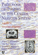 Pathology of Tumors of the Central Nervous System: A Guide to Histologic Diagnosis