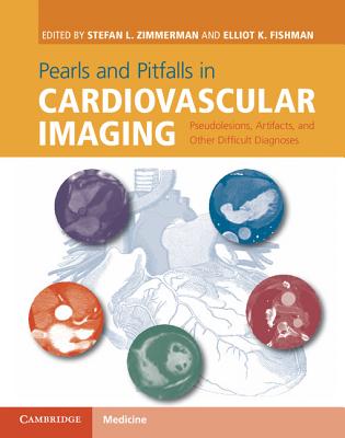 Pearls and Pitfalls in Cardiovascular Imaging: Pseudolesions, Artifacts, and Other Difficult Diagnoses - Zimmerman, Stefan L. (Editor), and Fishman, Elliot K. (Editor)