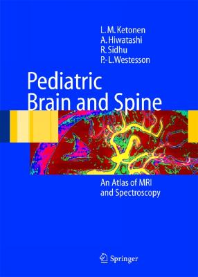 Pediatric Brain and Spine: An Atlas of MRI and Spectroscopy - Ketonen, L M, and Hiwatashi, A, and Sidhu, R