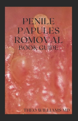 Penile Papules Romoval Book Guide: The Ultimate Guide On How To Remove Pearly Penile Papules Using Natural Remedies - Williams, Theo, MD