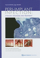 Peri-Implant Infection: Etiology, Diagnosis and Treatment
