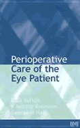 Perioperative Care of the Eye Patient