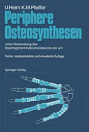 Periphere Osteosynthesen: Unter Verwendung Des Kleinfragment-Instrumentariums Der Ao