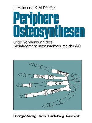 Periphere Osteosynthesen: Unter Verwendung Des Kleinfragment-Instrumentariums Der Ao - Meuli, H C, and Heim, Urs, and Pfeiffer, Karl M