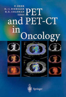 Pet and Pet-CT in Oncology - Oehr, Peter (Editor), and Biersack, Hans-Jrgen (Editor), and Coleman, R Edward, MD (Editor)