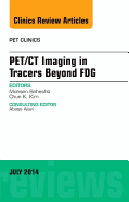 Pet/CT Imaging in Tracers Beyond Fdg, an Issue of Pet Clinics: Volume 9-3