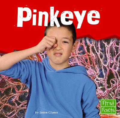 Pinkeye - Glaser, Jason