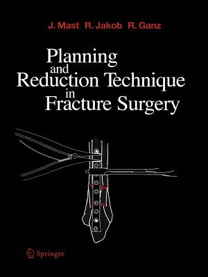 Planning and Reduction Technique in Fracture Surgery - Mast, Jeffrey, and Willenegger, H (Foreword by), and Jakob, Roland, and Ganz, Reinhold