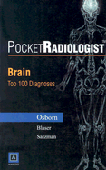 Pocketradiologist - Brain: Top 100 Diagnoses