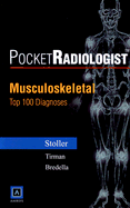 Pocketradiologist - Musculoskeletal: Top 100 Diagnoses