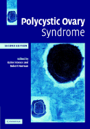 Polycystic Ovary Syndrome