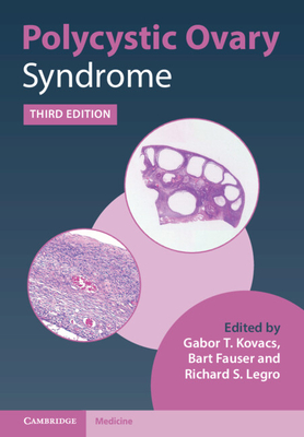 Polycystic Ovary Syndrome - Kovacs, Gabor T. (Editor), and Fauser, Bart (Editor), and Legro, Richard S. (Editor)