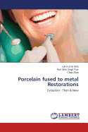 Porcelain fused to metal Restorations - Bida Lalit Kumar, and Toor Ravi Sher Singh, and Bida Charu