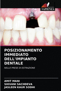 Posizionamento Immediato Dell'impianto Dentale