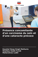Pr?sence concomitante d'un carcinome du sein et d'une cataracte pr?coce