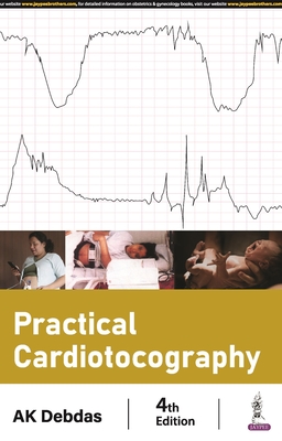 Practical Cardiotocography - Debdas, AK