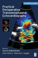 Practical Perioperative Transoesophageal Echocardiography: Text with CD-ROM
