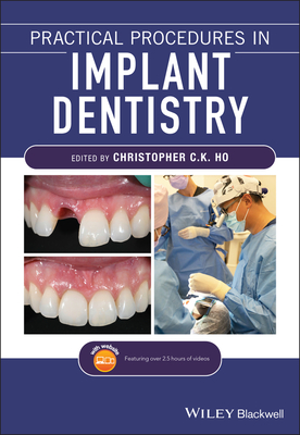 Practical Procedures in Implant Dentistry - Ho, Christopher C. K. (Editor)