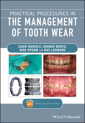 Practical Procedures in the Management of Tooth Wear - Banerji, Subir, and Mehta, Shamir B., and Opdam, Niek