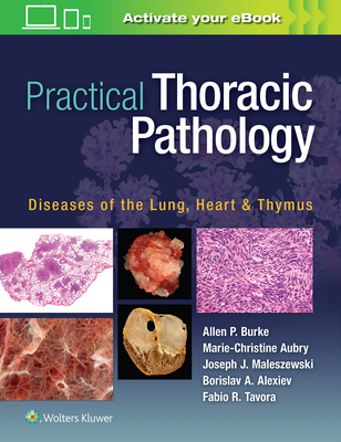 Practical Thoracic Pathology: Diseases of the Lung, Heart, and Thymus - Burke, Allen P, MD, and Aubry, Marie-Christine, MD, and Maleszewski, Joseph, MD