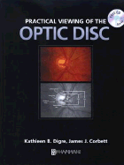Practical Viewing of the Optic Disc