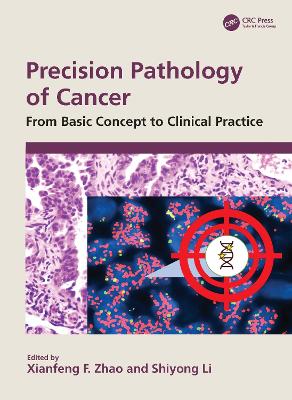 Precision Pathology of Cancer: From Basic Concept to Clinical Practice - F Zhao, Xianfeng (Editor), and Li, Shiyong (Editor)