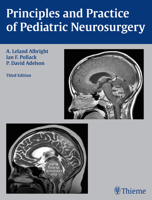 Principles and Practice of Pediatric Neurosurgery - Albright, A Leland, and Pollack, Ian F, and Adelson, P David