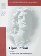 Procedures in Cosmetic Dermatology Series: Liposuction: Text with DVD