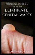 Profound Guide to Eliminate Genital Warts: The Ultimate Guide To Eliminate Genital Warts