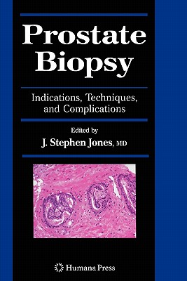 Prostate Biopsy: Indications, Techniques, and Complications - Jones, J. Stephen, M.D. (Editor)