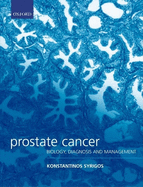 Prostate Cancer: Biology, Diagnosis and Management