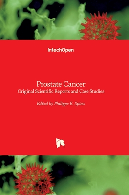 Prostate Cancer: Original Scientific Reports and Case Studies - Spiess, Philippe E (Editor)