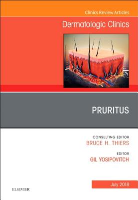 Pruritus, an Issue of Dermatologic Clinics: Volume 36-3 - Yosipovitch, Gil, MD