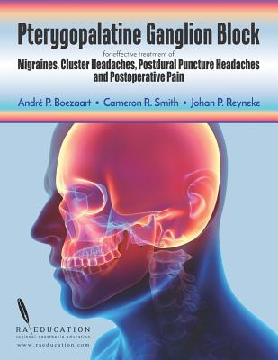 Pterygopalatine Ganglion Block: for effective treatment of Migraine, Cluster Headache, Postdural Puncture Headache & Postoperative Pain - Smith, Cameron R, and Reyneke, Johan P, and Boezaart, Andre P