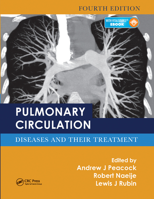 Pulmonary Circulation: Diseases and Their Treatment, Fourth Edition - Peacock, Andrew J. (Editor), and Naeije, Robert (Editor), and Rubin, Lewis J. (Editor)