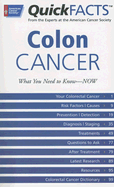 Quick Facts Colon Cancer: What You Need to Know -- Now