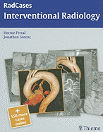 Radcases Interventional Radiology