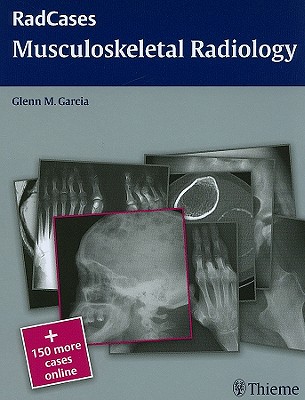 Radcases Musculoskeletal Radiology - Garcia, Glenn M (Editor)