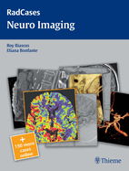 Radcases Neuro Imaging