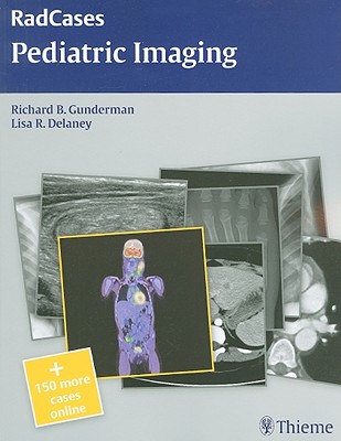 Radcases Pediatric Imaging - Gunderman, Richard B, and Delaney, Lisa R